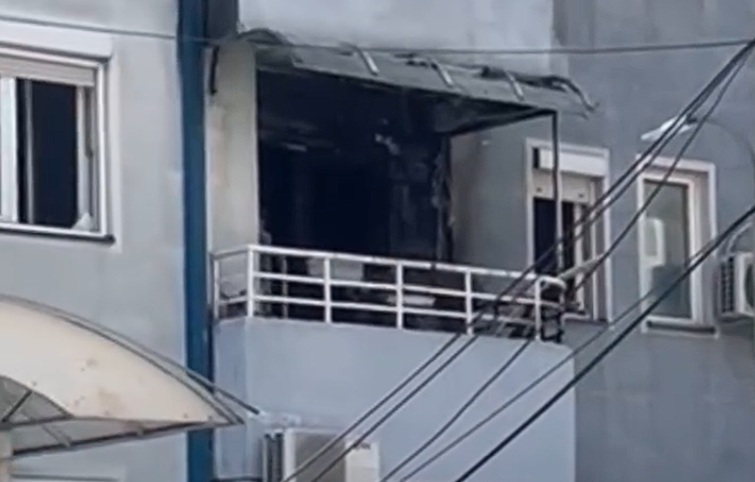 13-годишно дете заврши со изгореници во болница, настанал пожар додека готвел